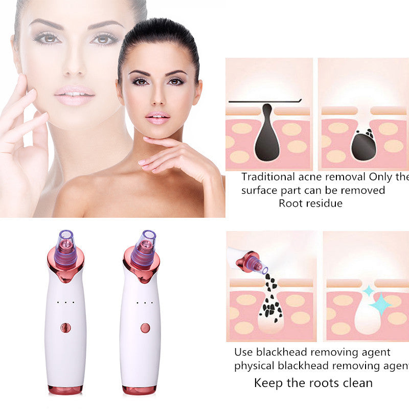 Ultimate Blackhead Remover: Powerful Acne Vacuum for Clear, Smooth Skin