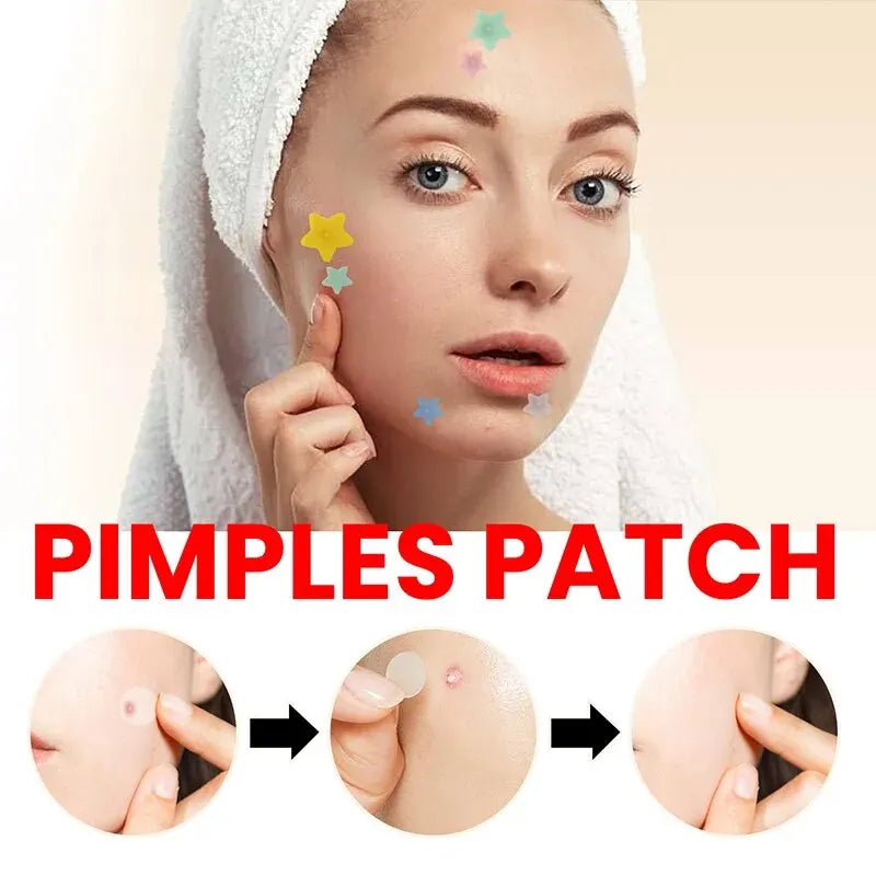 200 count Pimple Patch Skin Care Repair